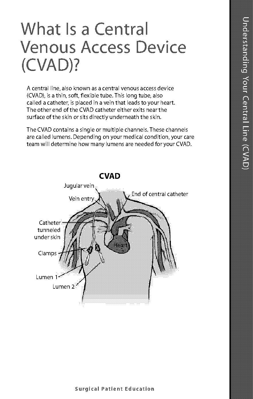 within a vein medical term