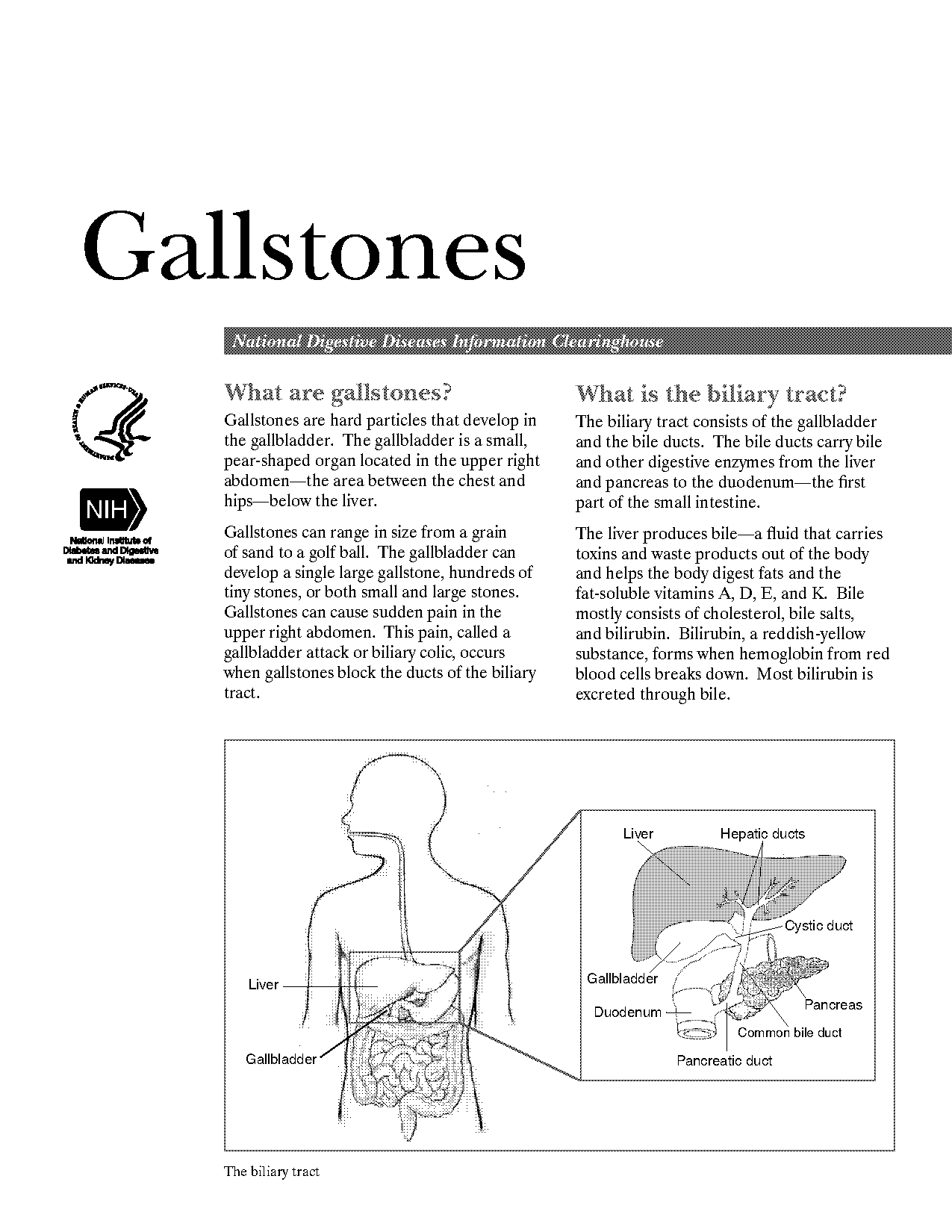 attacks of gallstones medical term